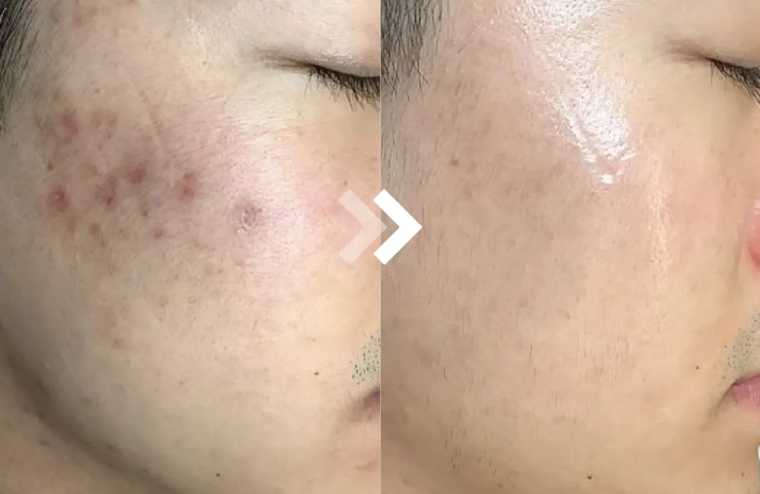 รีวิว media cell