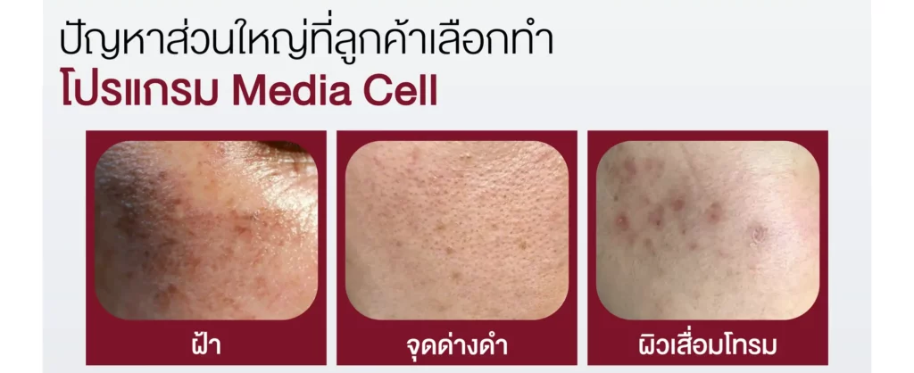 ปัญหาส่วนใหญ่ที่ลูกค้าเลือกทำโปรแกรม media cell