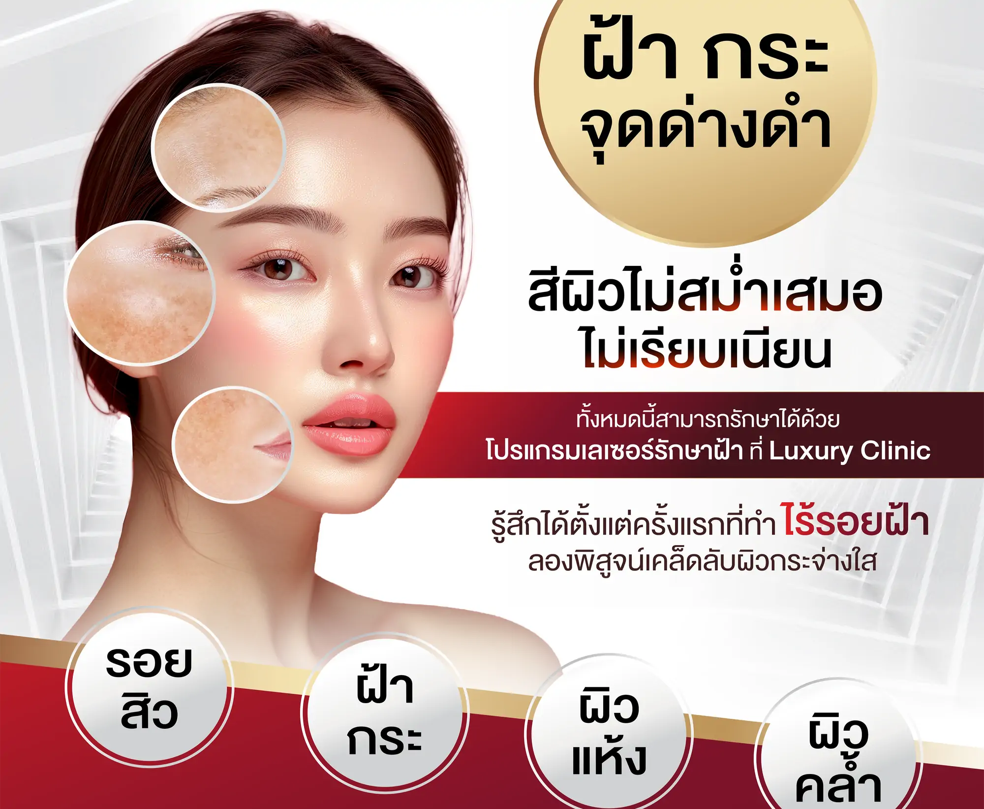 Helios III ฝ้า กระ จุดด่างดำ