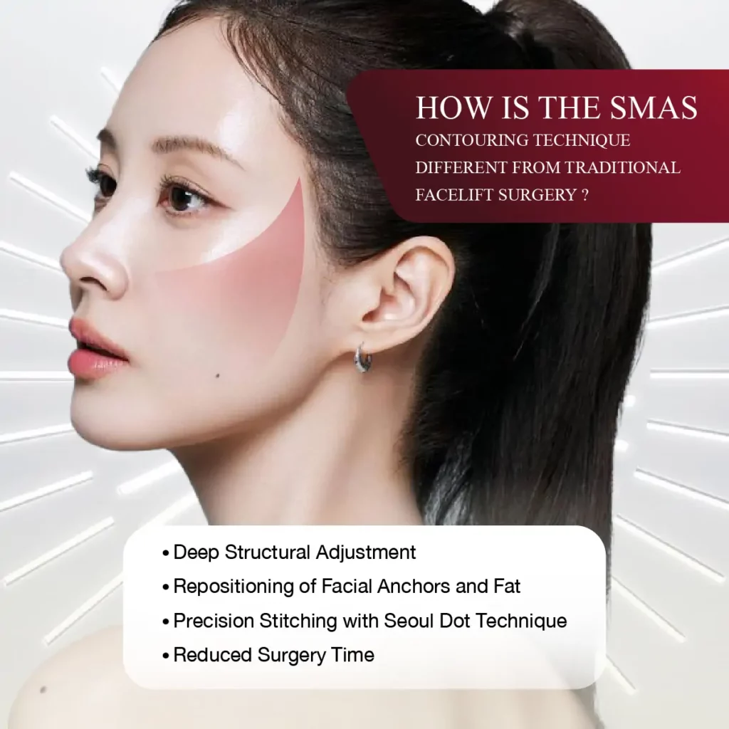 how is the smas