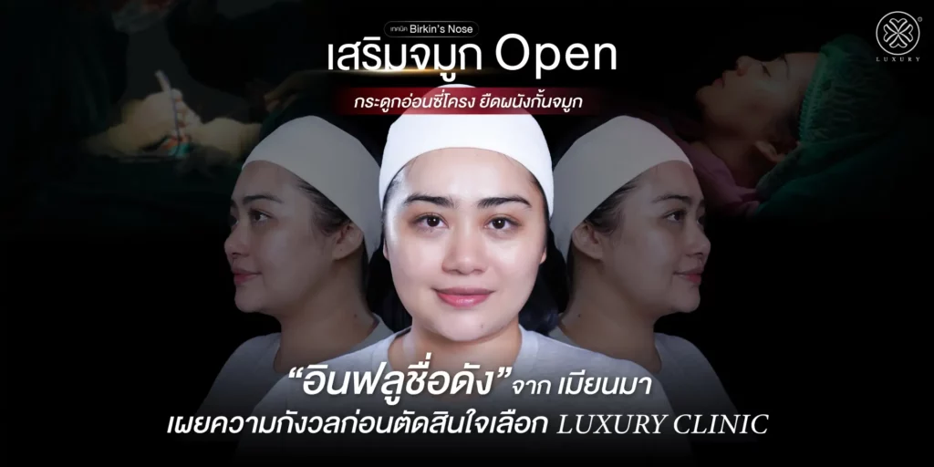 รีวิวเสริมจมูก by ทิลี่