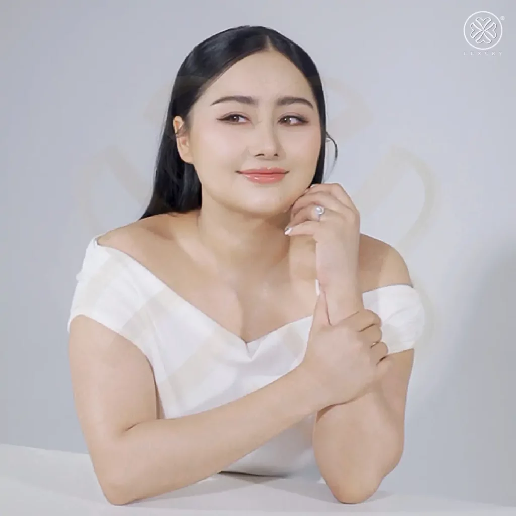 รีวิวเสริมจมูก by ทิลี่
