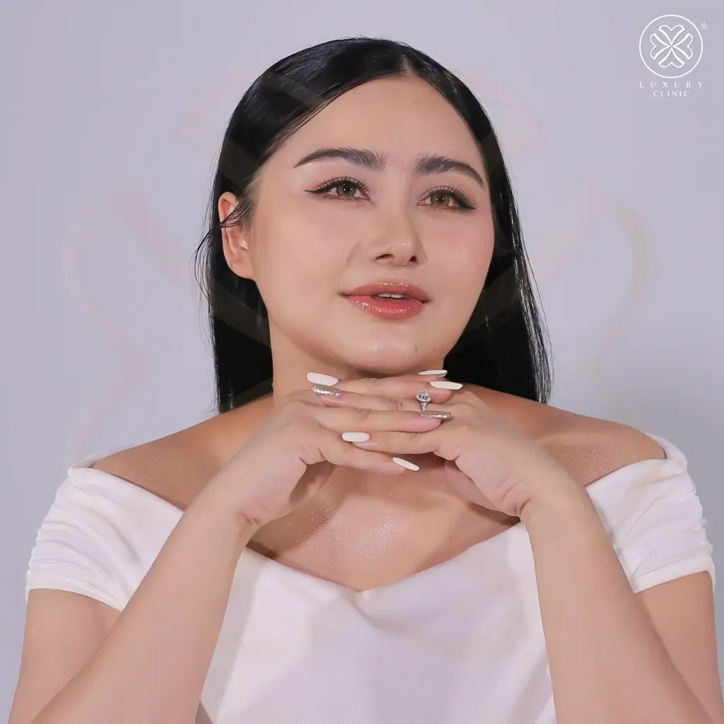 รีวิวเสริมจมูก by ทิลี่