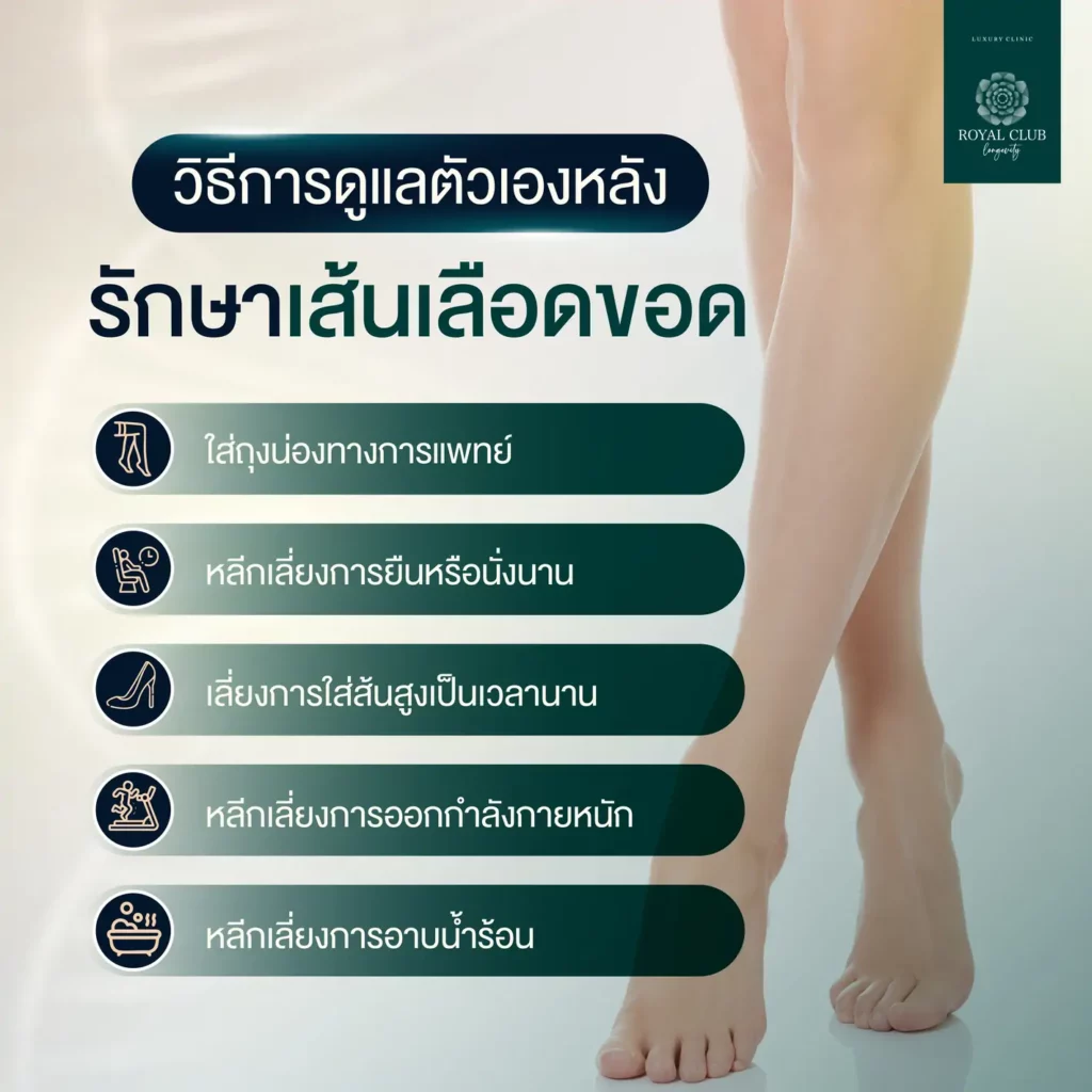 วิธีการดูแลตัวเองหลังรักษาเส้นเลือดขอด