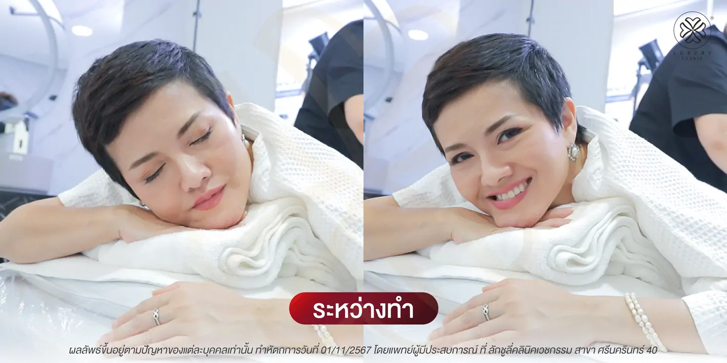 ระหว่างทำ legdef