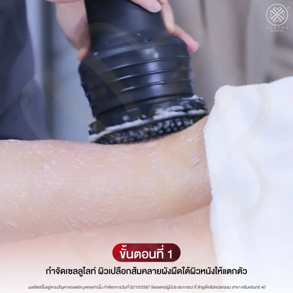 ขั้นตอนทำโปรแกรม LegDEF