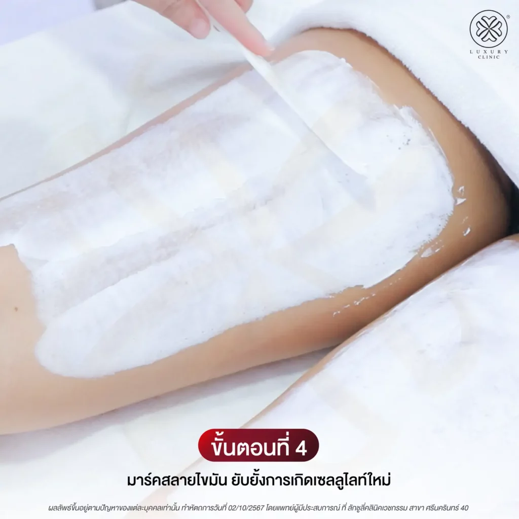 ขั้นตอนทำโปรแกรม LegDEF