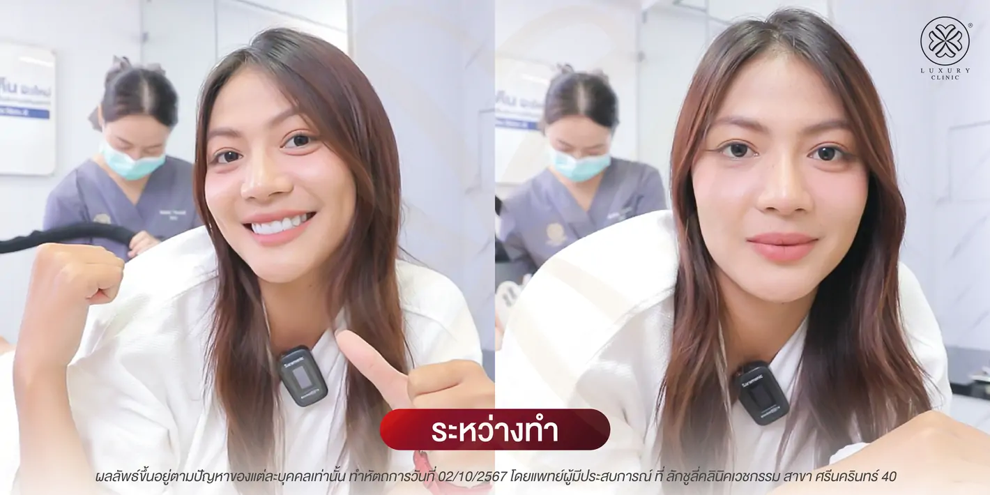 ระหว่างทำ