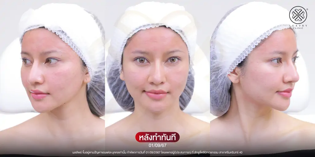รีวิว media cell คุณน้ำมนต์