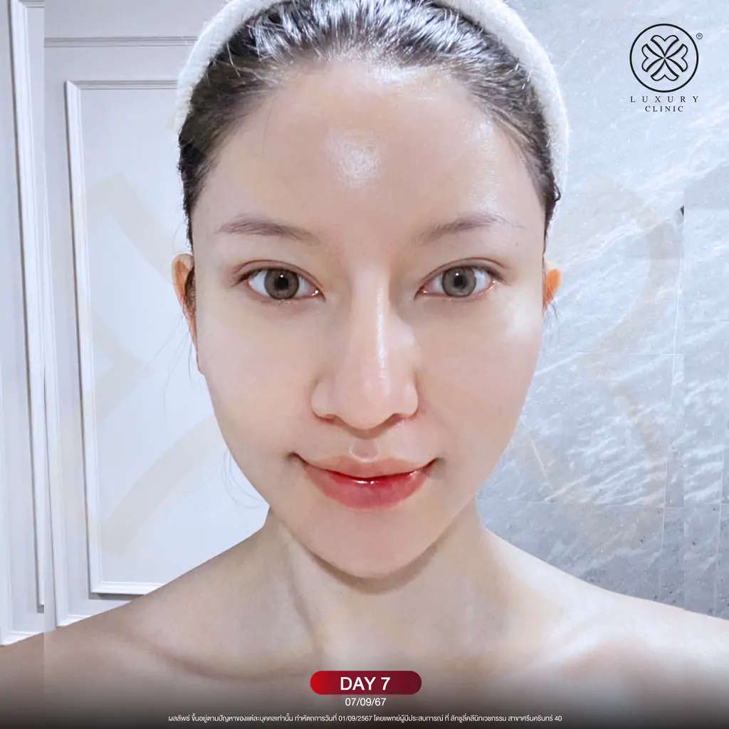 รีวิว media cell คุณน้ำมนต์