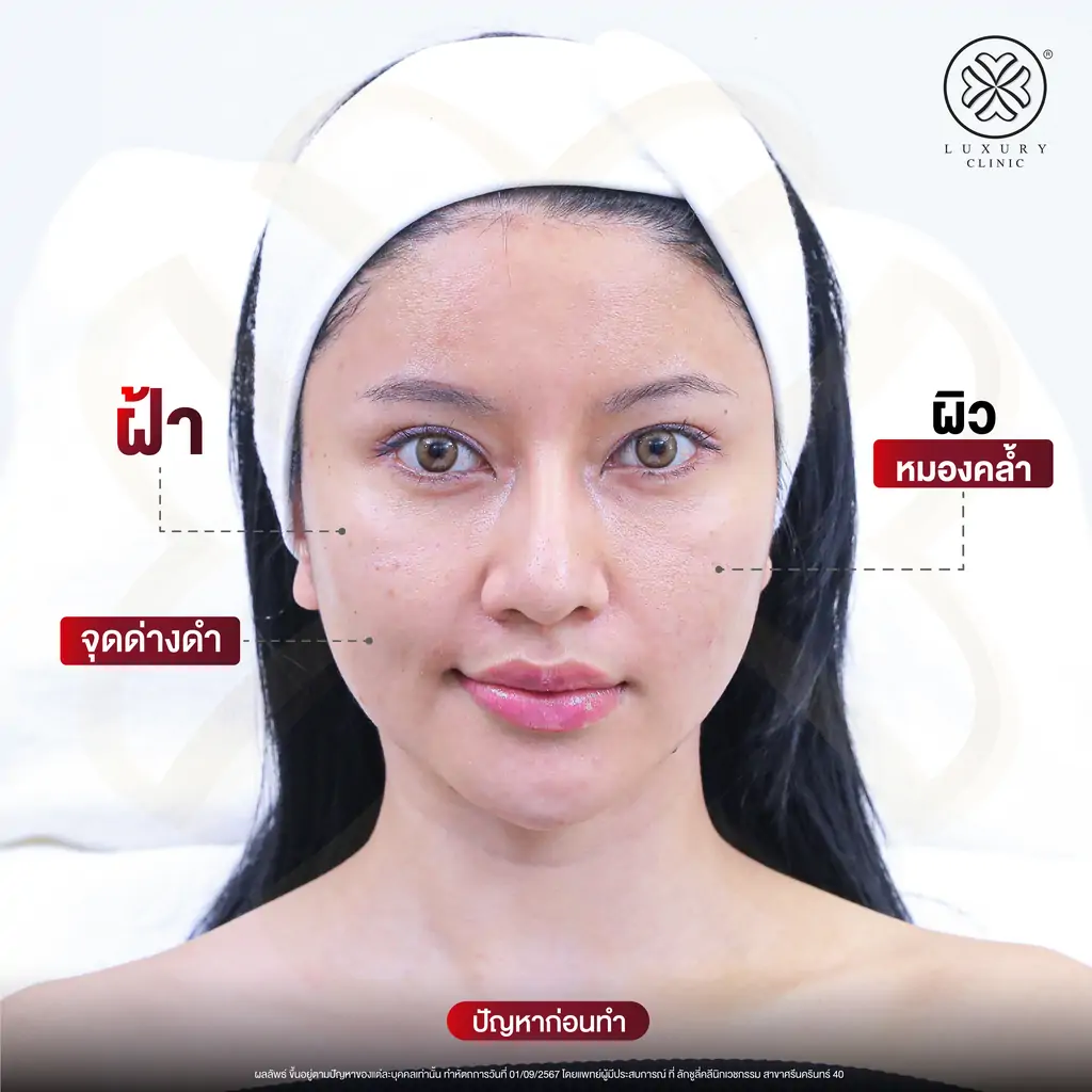 รีวิว media cell คุณน้ำมนต์