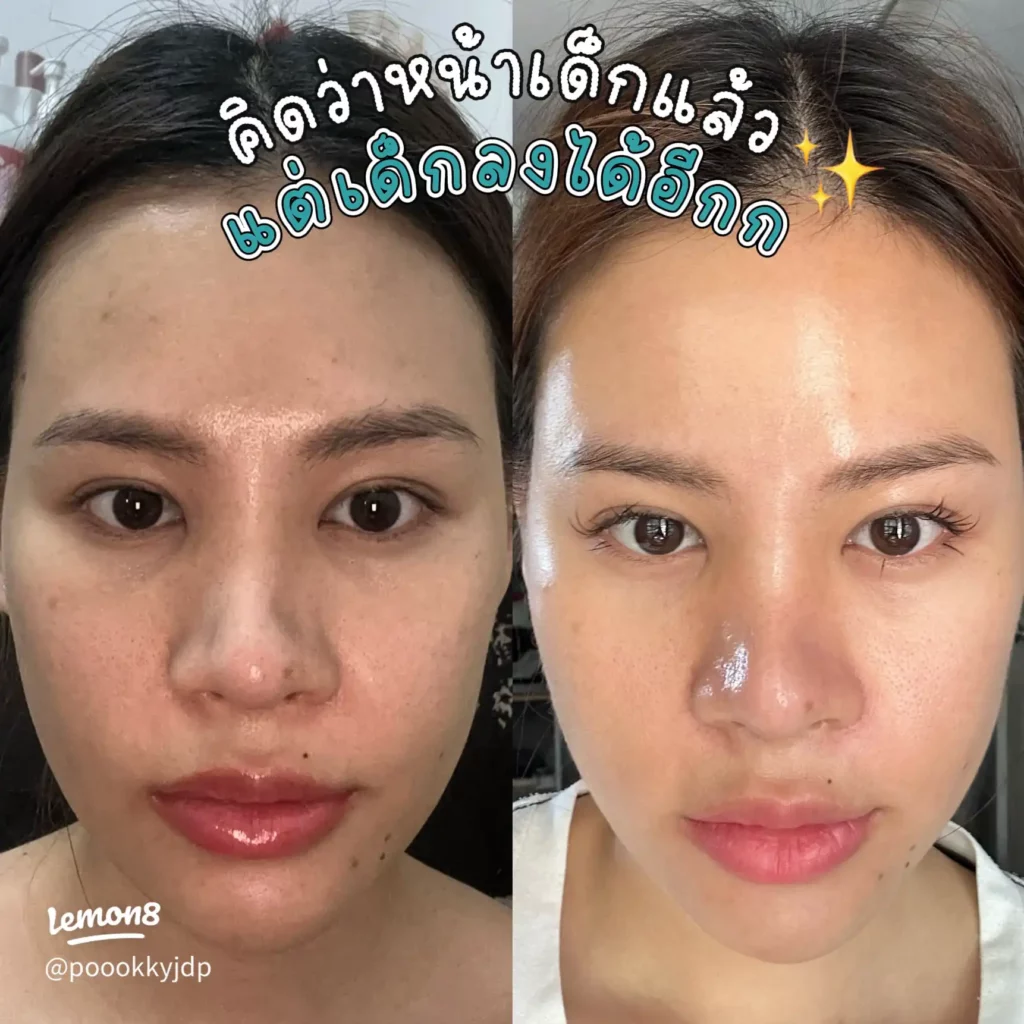 คิดว่าหน้าเด็กแล้ว