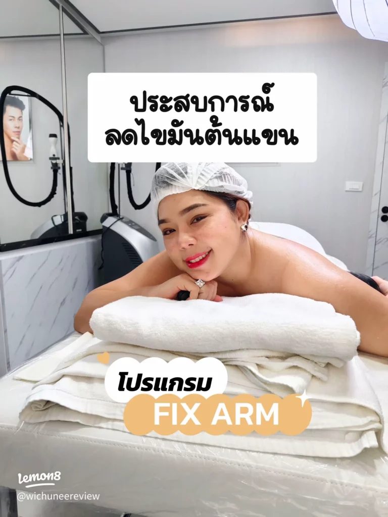FIX ARM