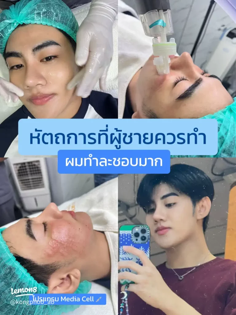 หัตถการที่ทำละชอบ Media Cell