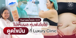 รีวิวดูดไขมัน