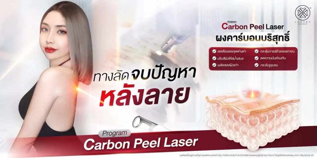 ทางลัดจบปัญหาหลังลาย