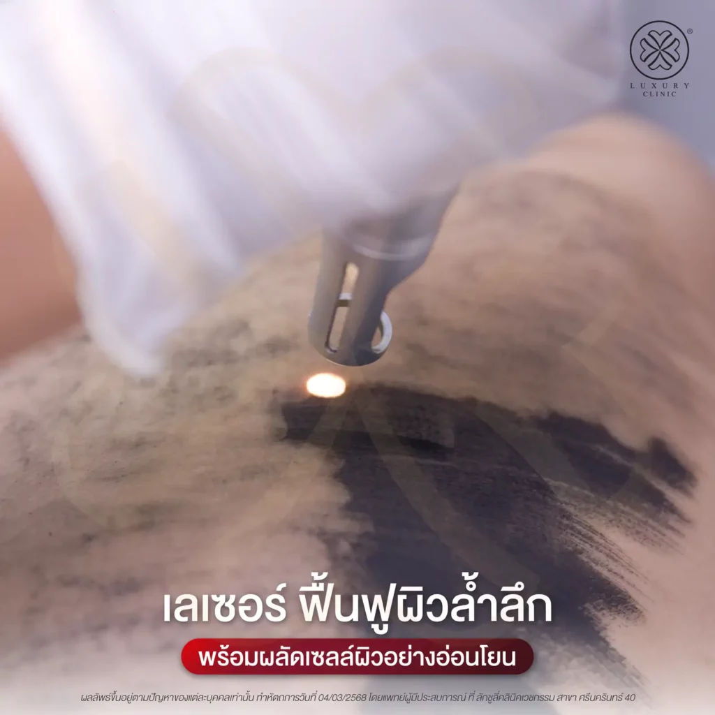 การทำงานของโปรแกรม Carbon Peel Laser