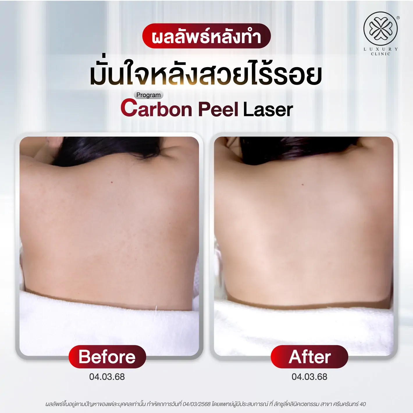 ผลลัพธ์หลังทำ (After)