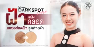 dark spot รักษาฝ้า