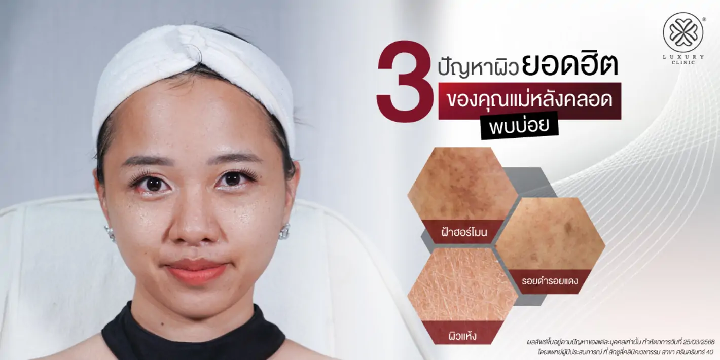 3 ปัญหาผิวยอดฮิต