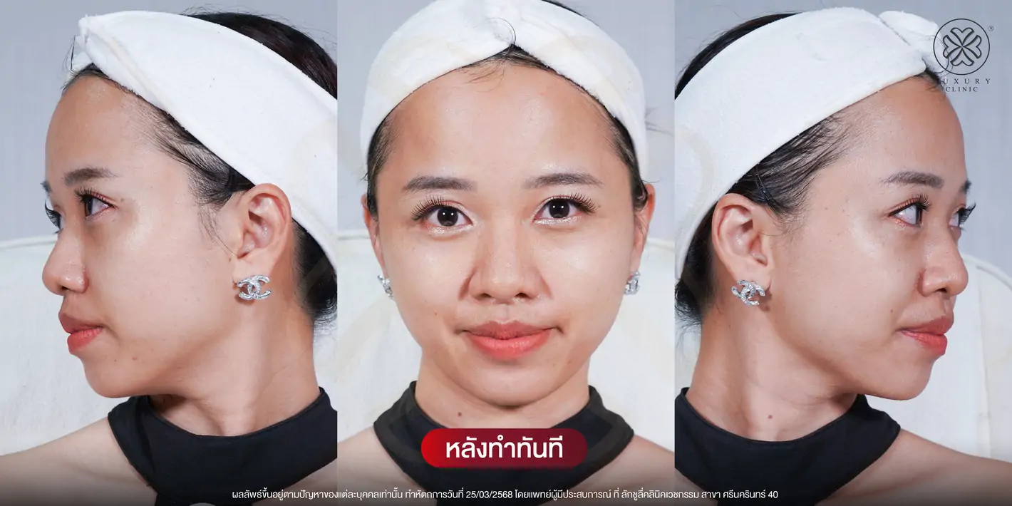 หลังทำทันที