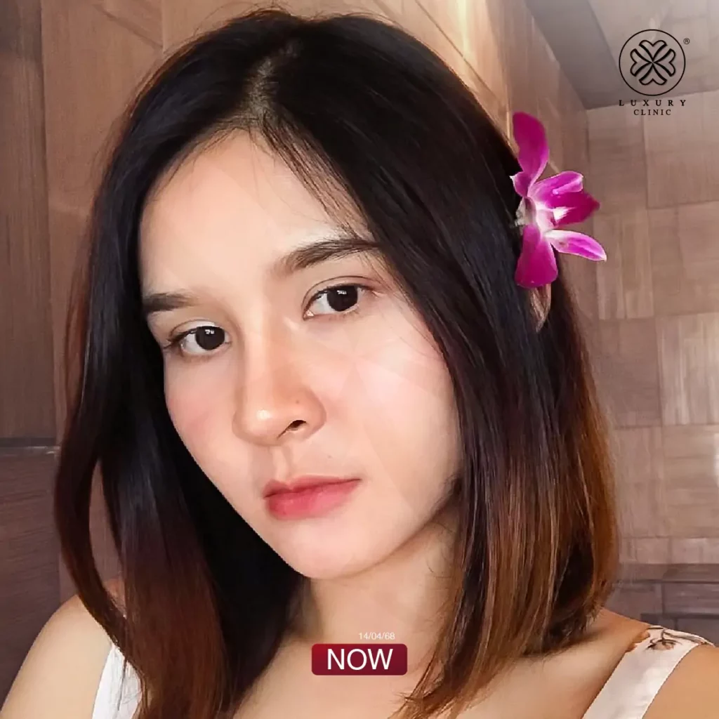 now