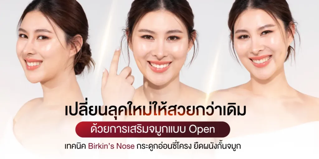 เปลี่ยนลุคใหม่ให้สวยกว่าเดิม ด้วยการเสริมจมูกแบบ Open