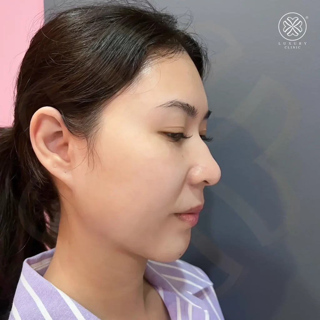 ภาพก่อนทำ
