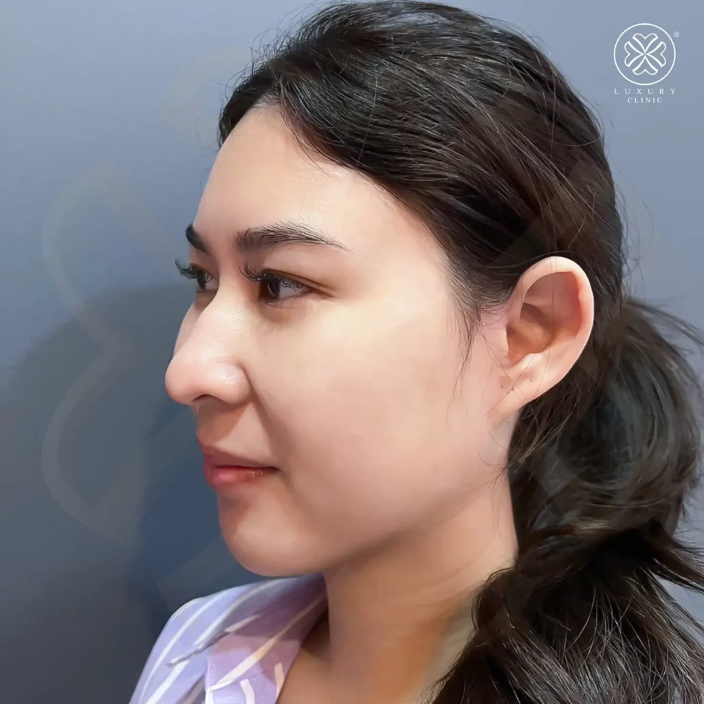 ภาพก่อนทำ