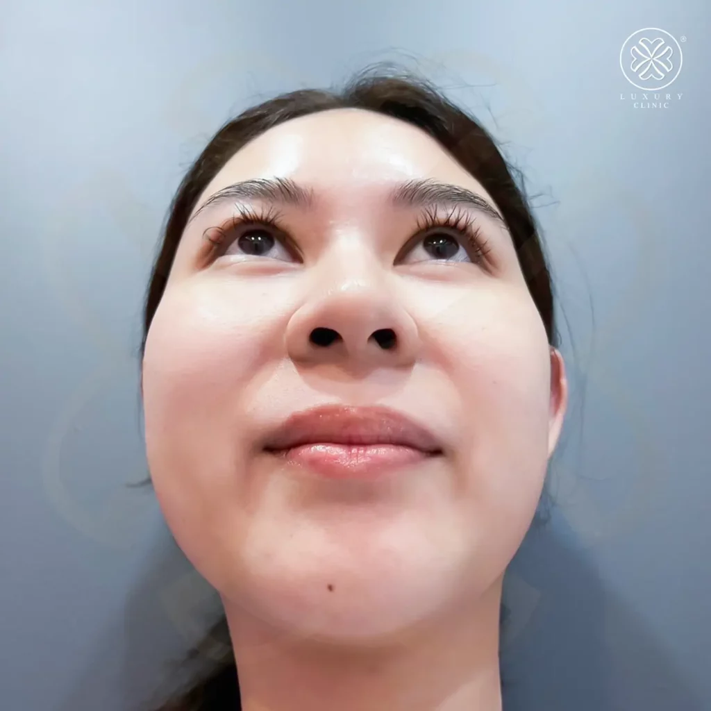 ภาพก่อนทำ