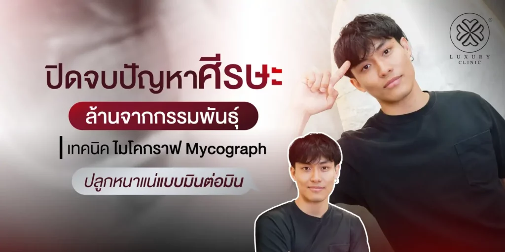 ปิดจบปัญหาศีรษะจากกรรมพันธุ์ ด้วยไมโคกราฟ Mycograph
