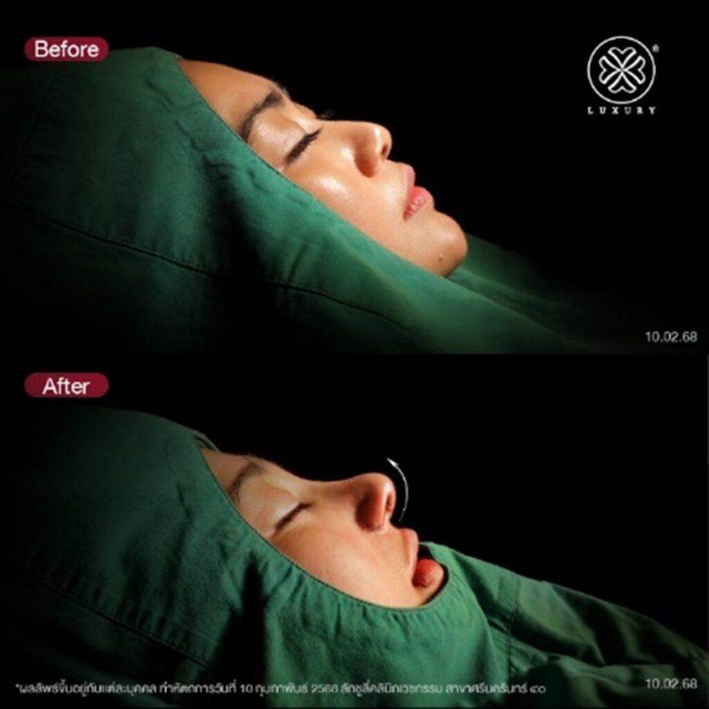 before - after