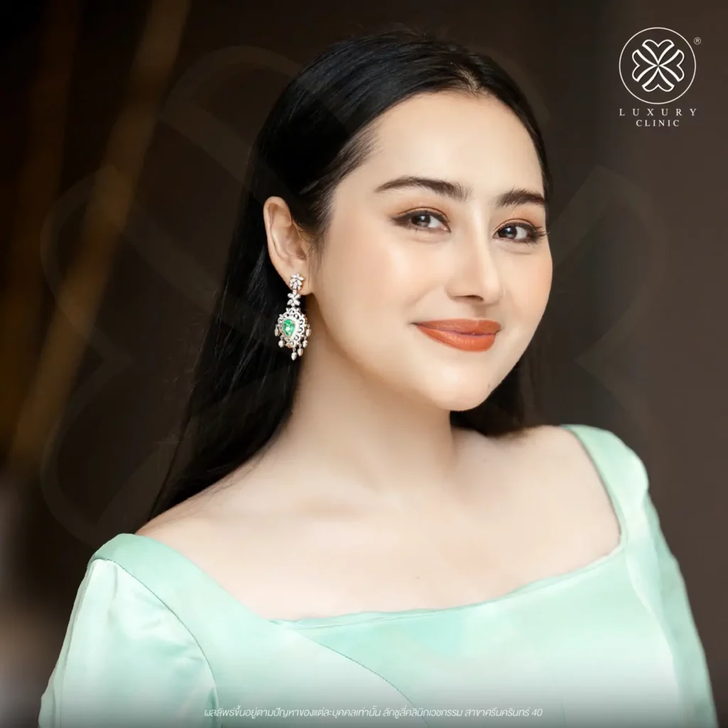 ปัจจุบันทำจมูกครบ 4 เดือน