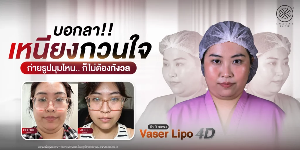 บอกลาเหนียงกวนใจ