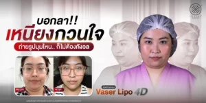 บอกลาเหนียงกวนใจ