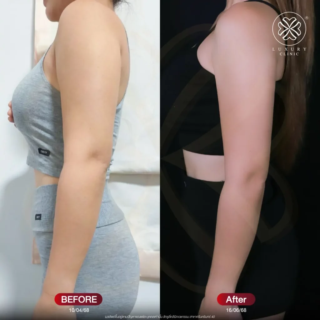 before - after