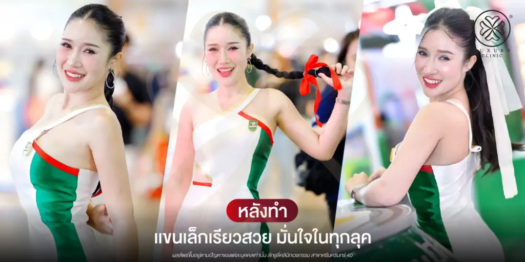 หลังทำ แขนเล็กเรียวสวย