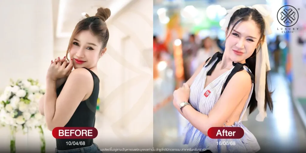 before - after