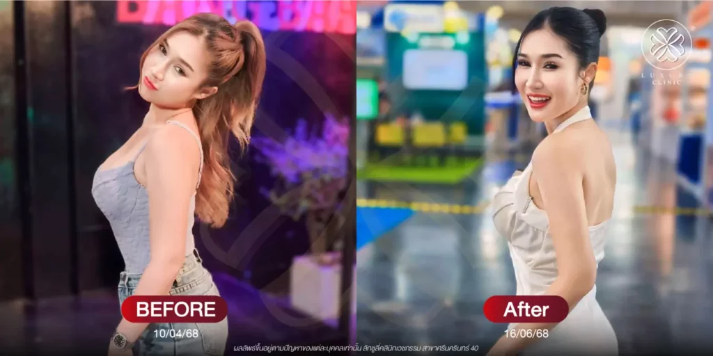 before - after