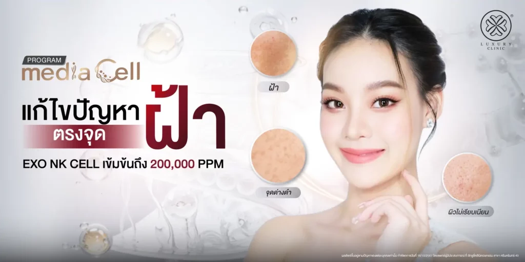media cell แก้ไขปัญหาฝ้าอย่างตรงจุด luxury clinic