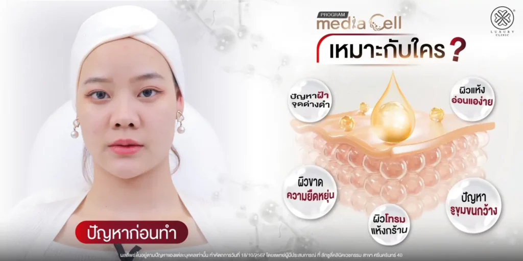 media cell เหมาะกับใคร ปัญหาฝ้า จุดด่างดำ luxury clinic