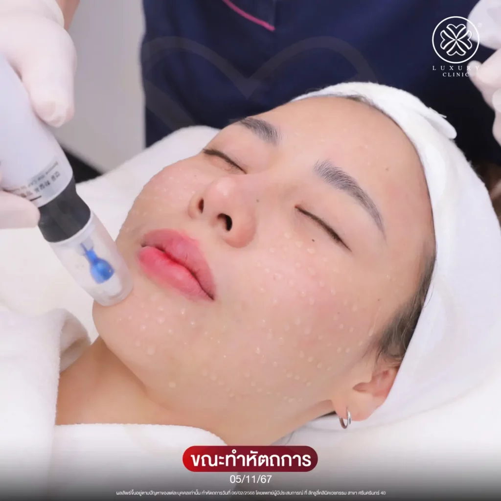 โปรแกรม SAMOA ตัวช่วยบูสต์ผิวฉ่ำ ล็อคความชุ่มชื้น
