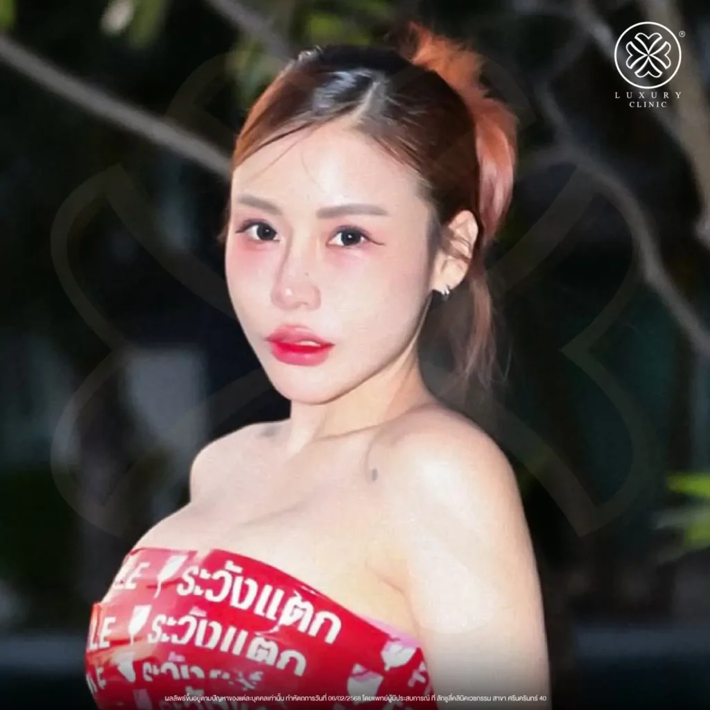 อัปเดตผิวหน้าหลังทำ (After)