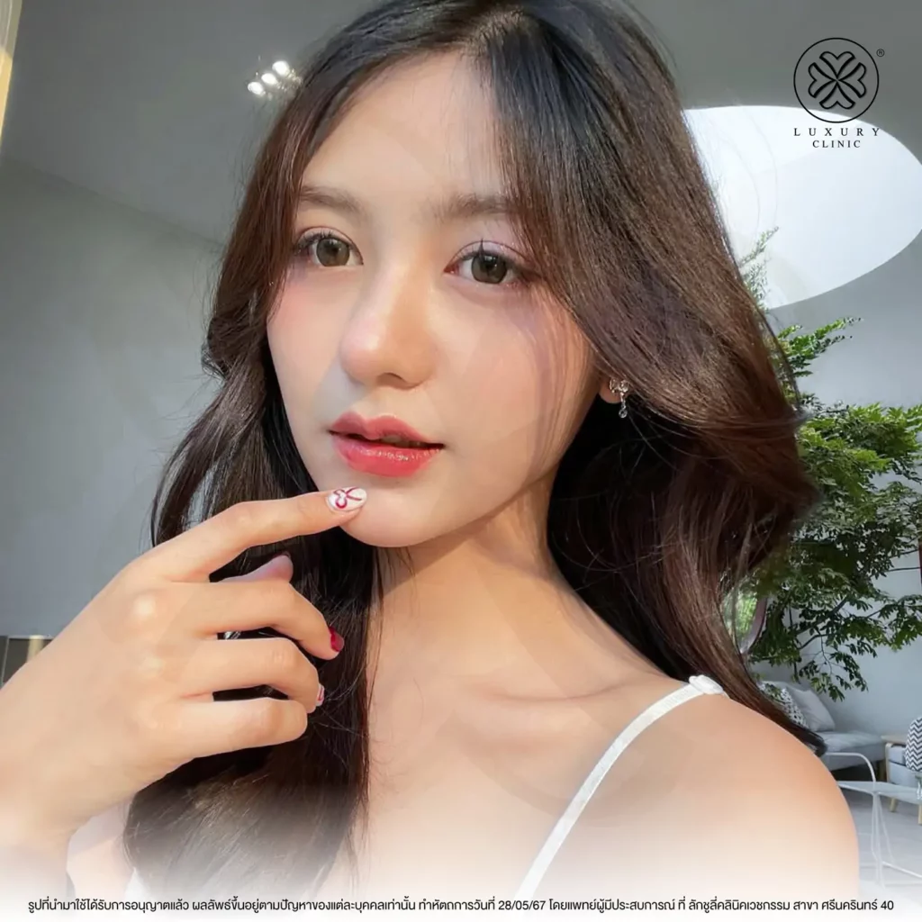 ฟ้ารู้สึกได้เลยค่ะว่าหลังทำรู้สึกสบายหน้ามากๆ