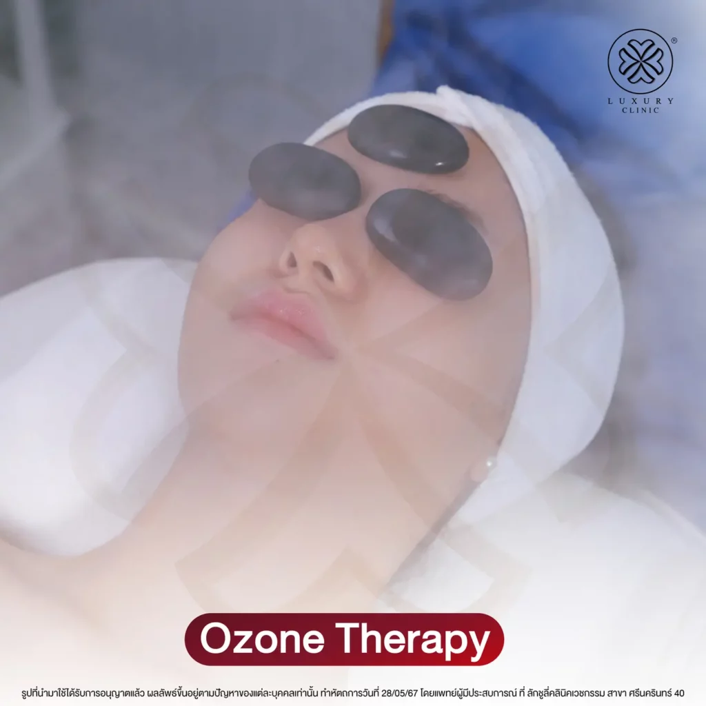 ขั้นตอน Ozone Therapy