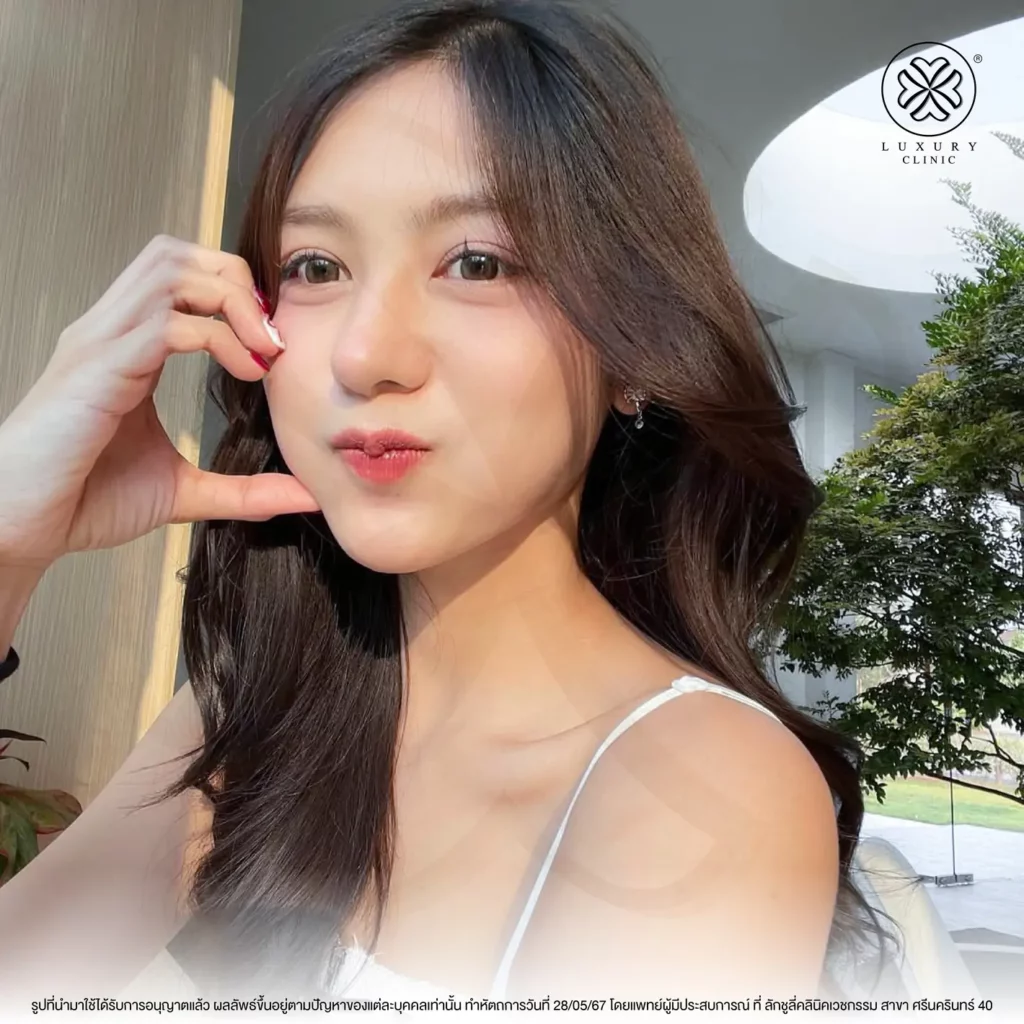 ฟ้ารู้สึกได้เลยค่ะว่าหลังทำรู้สึกสบายหน้ามากๆ
